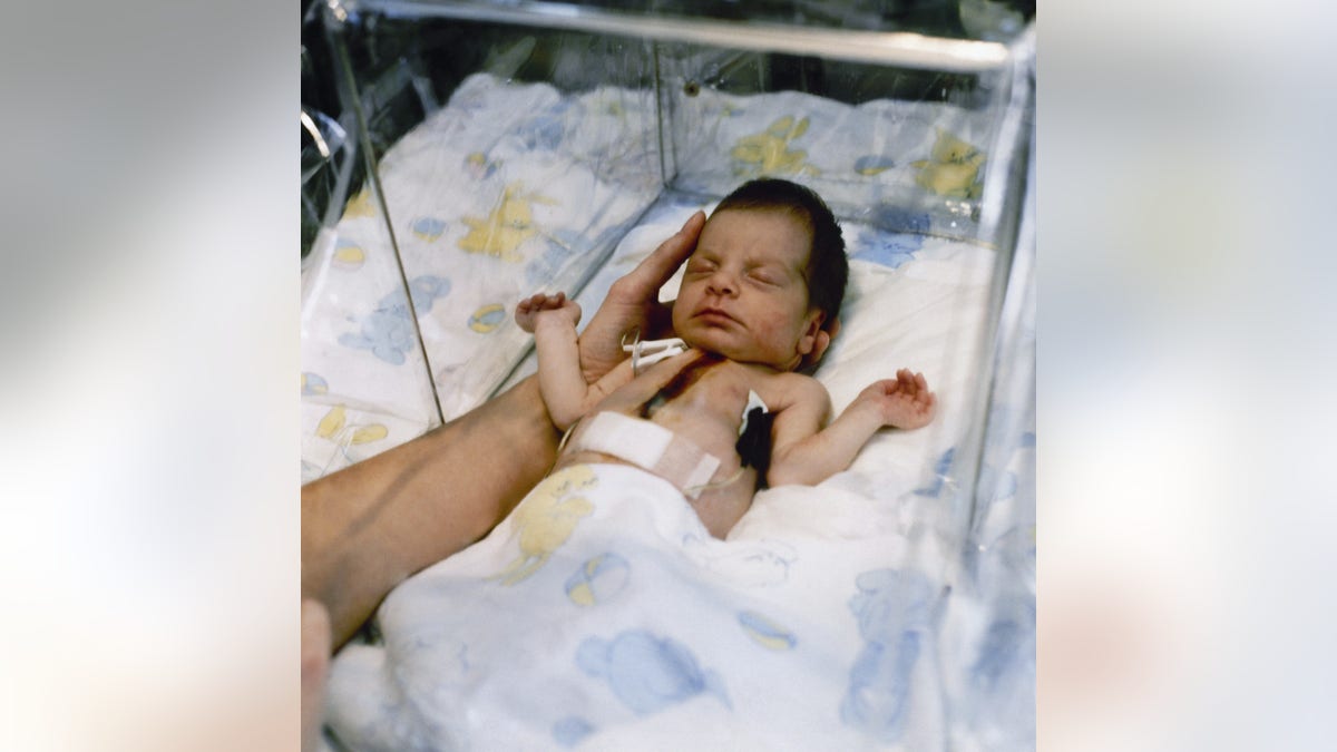 Baby Fae (AP Photo/Duane R. Miller)