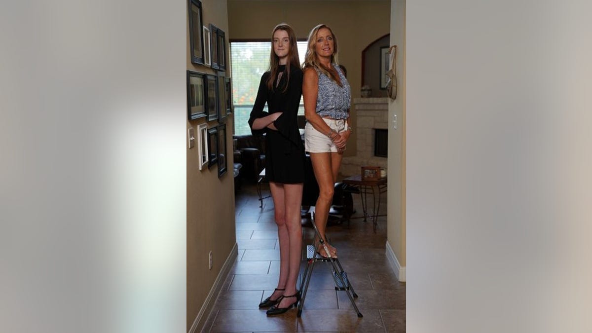 Texas girl, 17, breaks Guinness record for world's longest legs
