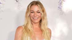 LeAnn Rimes bares all in post embracing her psoriasis: ‘This is my time to be honest’