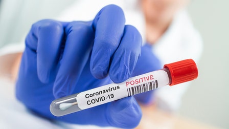 New coronavirus cases in US up by 11% over last week: report