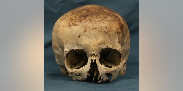 The partial skull of Wanda Ann Herr.