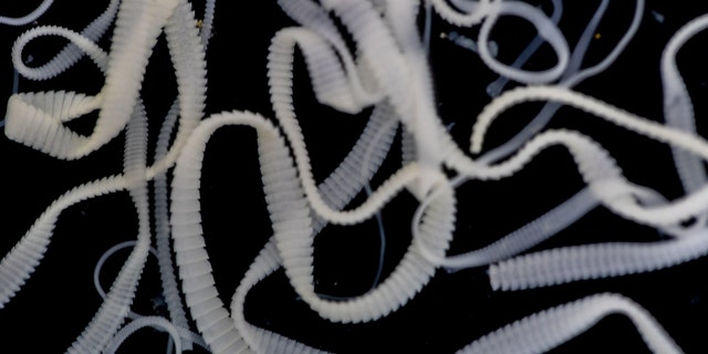 Just in time for Halloween, a new case report detailed the harrowing reason for an Australian woman’s persistent headache: tapeworm larvae.