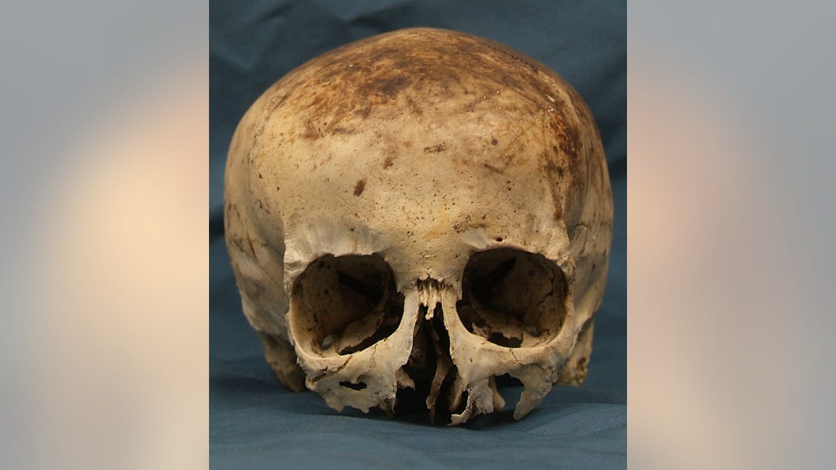 The skull was believed to have been in the woods for 10 years before it was discovered.