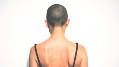 Man compliments waitress on bald head at wife's birthday dinner, suffers consequences for 'over a year'