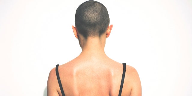 Ever since the incident, the man claims his wife brings up his comments about the woman's "great head shape."
