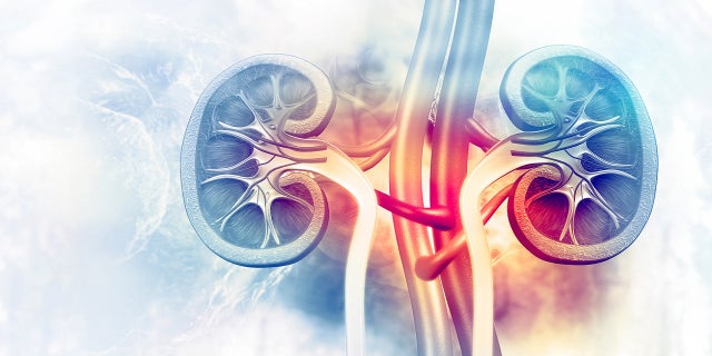 The first sign of the disease is often a kidney stone, per the Mayo Clinic. (iStock)