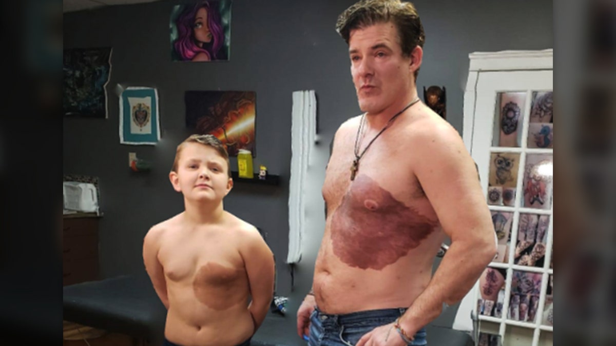 Derek Prue Sr. (right) got a tattoo that matches his son's (left) birthmark on his chest. 