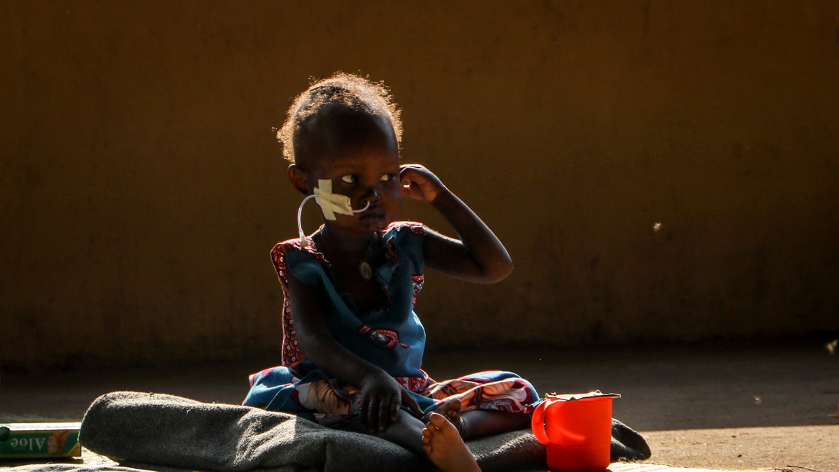 FILE - In this Thursday, Dec. 3, 2020 file photo, two year old Akon Morro, who is anemic and suffers from edema due to malnutrition, sits on the floor of a feeding center in Al Sabah Children's Hospital in the capital Juba, South Sudan. Economic fallout from the coronavirus pandemic has set back two decades of progress against the most severe forms of malnutrition and is likely to kill 168,000 children before a global recovery. That's according to a global study from a coalition of international organizations. (AP Photo/Sam Mednick, File)