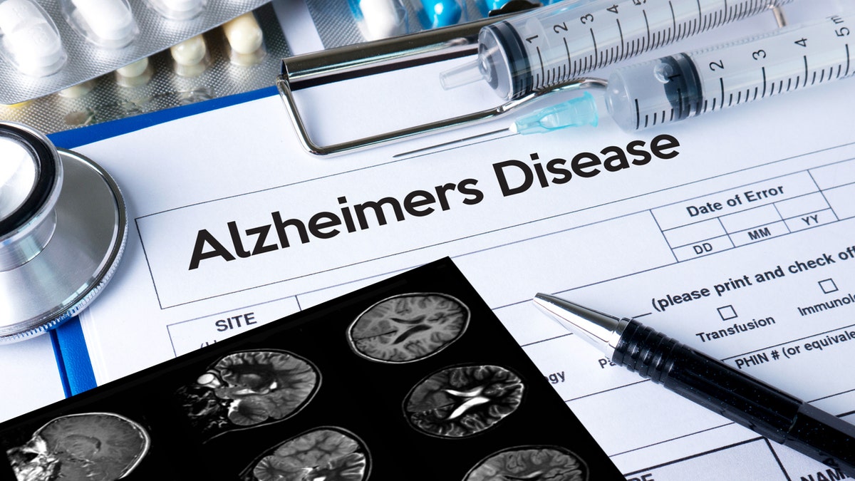 New medicine gives hope for Alzheimer's treatment.