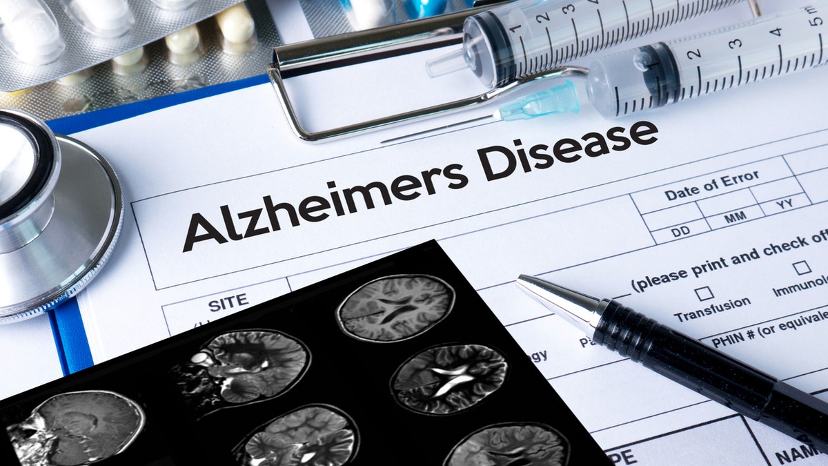 New medicine gives hope for Alzheimer's treatment.