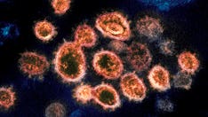 New studies show people who get COVID-19 less likely to get reinfected