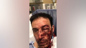 Boston suburb residents stay indoors due to random attacks as police up patrols, offer $5,000 reward