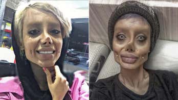 Instagram star nicknamed 'zombie Angelina Jolie' said surgery, photo-editing helped with transformation