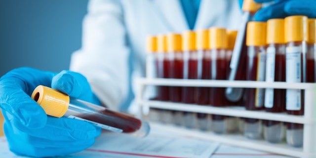 The conclusion is based on blood donations from the Red Cross from nine states, including Washington, Oregon, California, Connecticut, Iowa, Massachusetts, Michigan, Rhode Island and Wisconsin. (iStock)