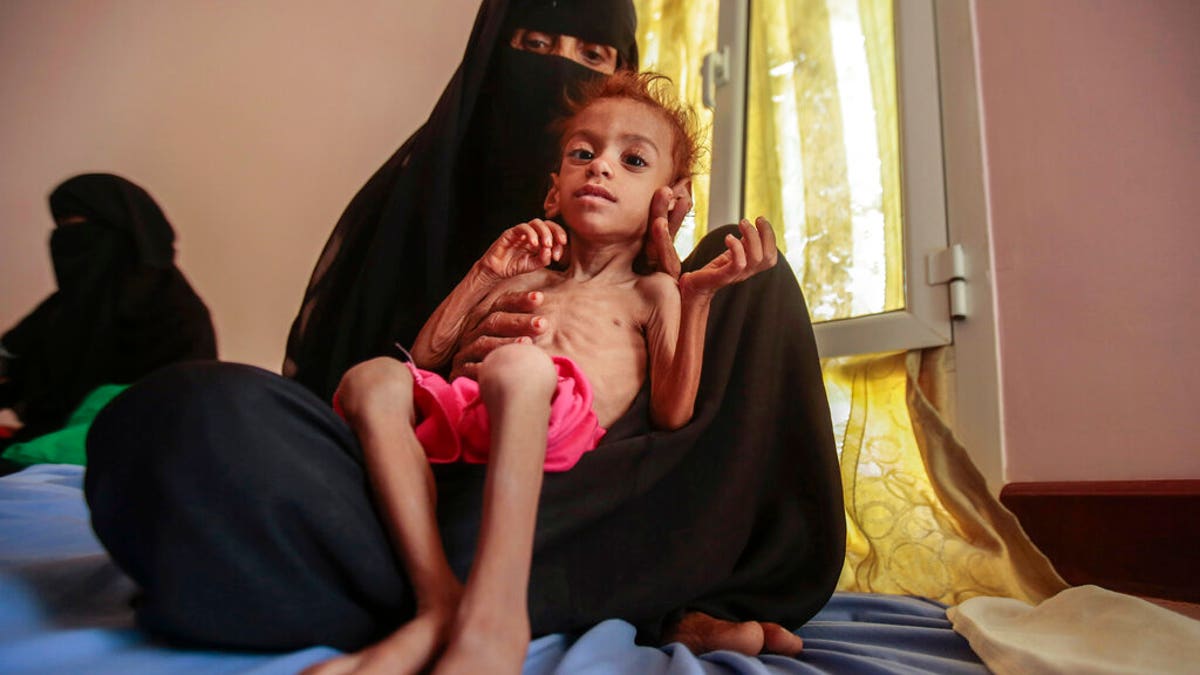 FILE - In this Oct. 1, 2018, file photo, a woman holds a malnourished boy at the Aslam Health Center, in Hajjah, Yemen. A leading aid organization on Monday warned that U.S. Secretary of State Mike Pompeo's move to designate Yemen’s Iran-backed Houthi rebels as a "foreign terrorist organization" would deal another "devastating blow" to the impoverished and war-torn nation. (AP Photo/Hani Mohammed, File)