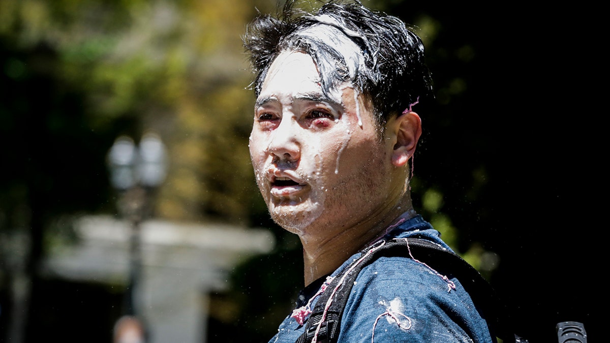 PORTLAND, OR - JUNE 29: Andy Ngo, a Portland-based journalist, is seen covered in unknown substance after unidentified Rose City Antifa members attacked him on June 29, 2019 in Portland, Oregon. Several groups from the left and right clashed after competing demonstrations at Pioneer Square, Chapman Square, and Waterfront Park spilled into the streets. According to police, medics treated eight people and three people were arrested during the demonstrations. (Photo by Moriah Ratner/Getty Images)