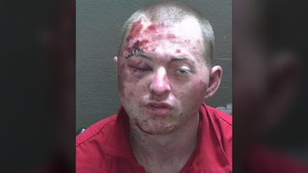 Florida man badly loses fight with police, K-9