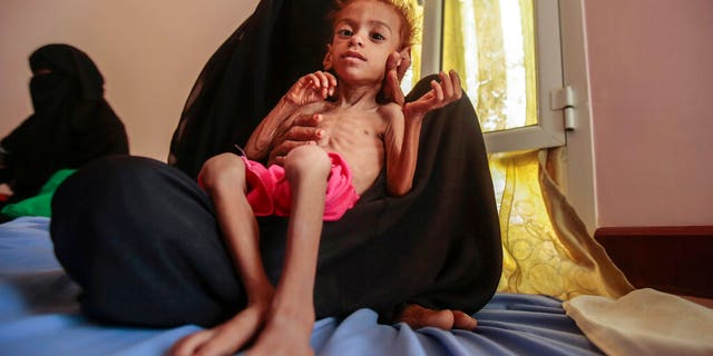 File-In this file photo from October 1, 2018, a woman holds a malnourished boy at the Aslam Health Center in Hajas State, Yemen.On Monday, a major aid organization warned that US Secretary of State Mike Pompeo’s move would designate Yemen’s Iran-backed Houthi rebels as