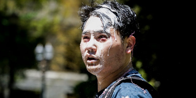 Andy Ngo, a Portland-based journalist, is seen covered in an unknown substance after unidentified Rose City Antifa members attacked him on June 29, 2019 in Portland, Ore. (Photo by Moriah Ratner/Getty Images)