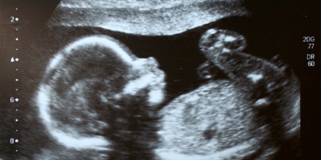 Parents Magazine published an article on ‘living wills’ from TikTokers who inform their doctors whether to save their life or the life of their baby if delivery complications should arise.