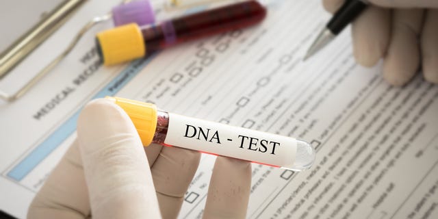 DNA test