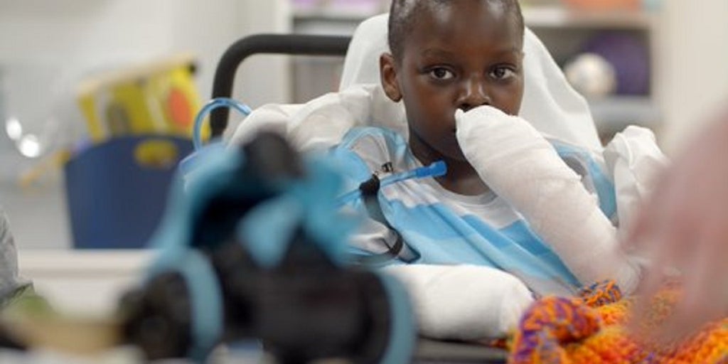 Michigan boy with rare coronavirus-related inflammatory illness endures 4 amputations - Vimarsana News