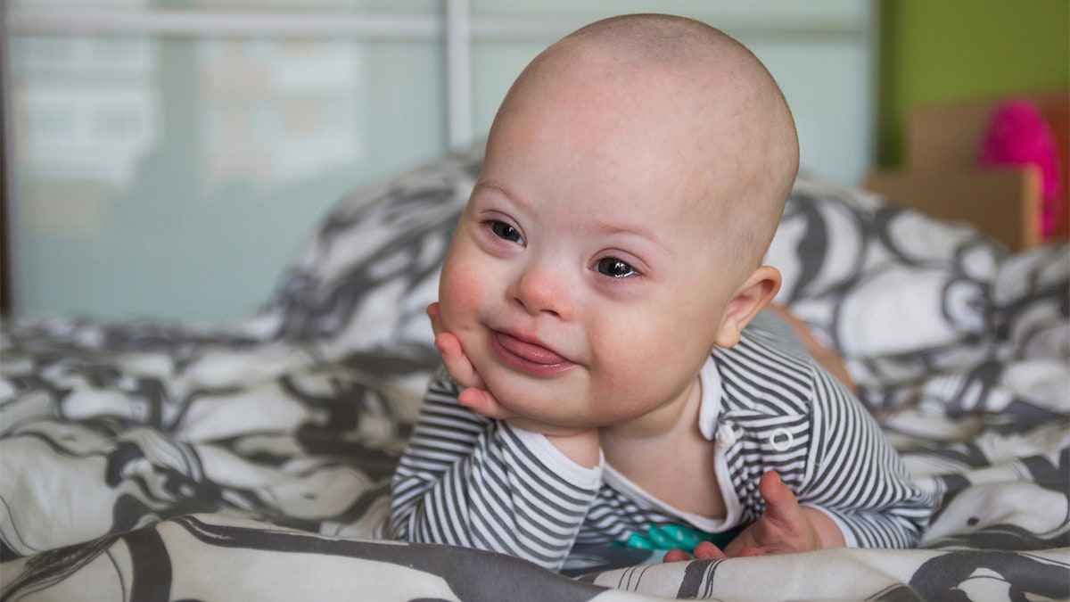 Portrait of cute baby boy with Down syndrome on the bed in home bedroom.