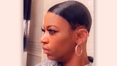 Woman who sprayed hair with Gorilla Glue debuts new look after surgery