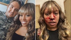 Alleah Taylor, ex-girlfriend of Chad Wheeler, recalls alleged vicious assault