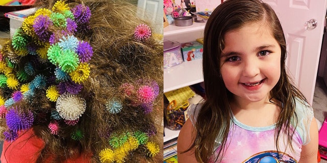 Mom slams Bunchems sticky toys after 150 get stuck in daughter's hair | Fox News Mom slams Bunchems sticky toys after 150 get stuck in daughter's hair | Fox News