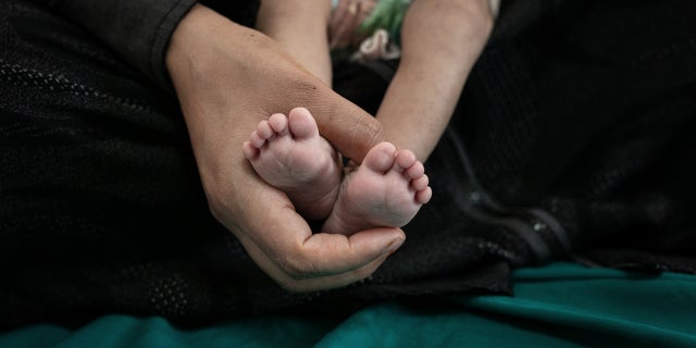 Ethar Omar Abdo Alshahar, a 4-month-old malnourished girl at the 22 May hospital in Sana'a in Yemen on 5 February 2020. (Courtesy: UNICEF)