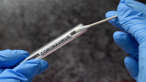 California detects New York, Brazil coronavirus variants