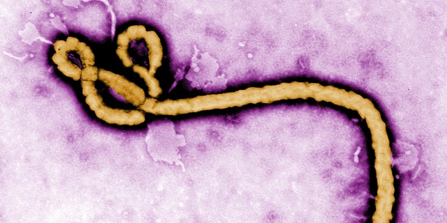 FILE - This undated colorized transmission electron micrograph file image made available by the Centers for Disease Control and Prevention (CDC) shows an Ebola virus virion. The World Health Organization said Thursday Feb. 18, 2021 that it will be sending more than 11,000 Ebola vaccinations to the West African nation of Guinea in the coming days to combat the recent epidemic of the deadly hemorrhagic fever that has been declared in the country's southern N'Zerekore region. (Frederick Murphy/CDC via AP, File)