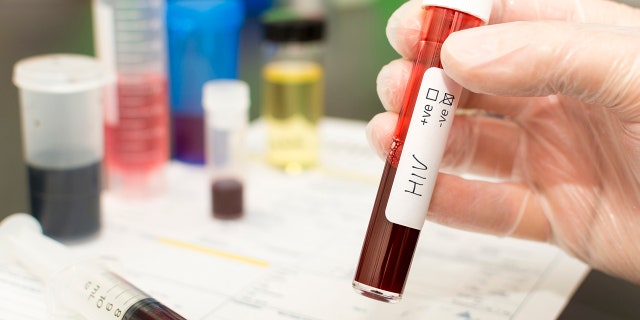 A test tube with blood in it. Handwritten label with HIV on it.