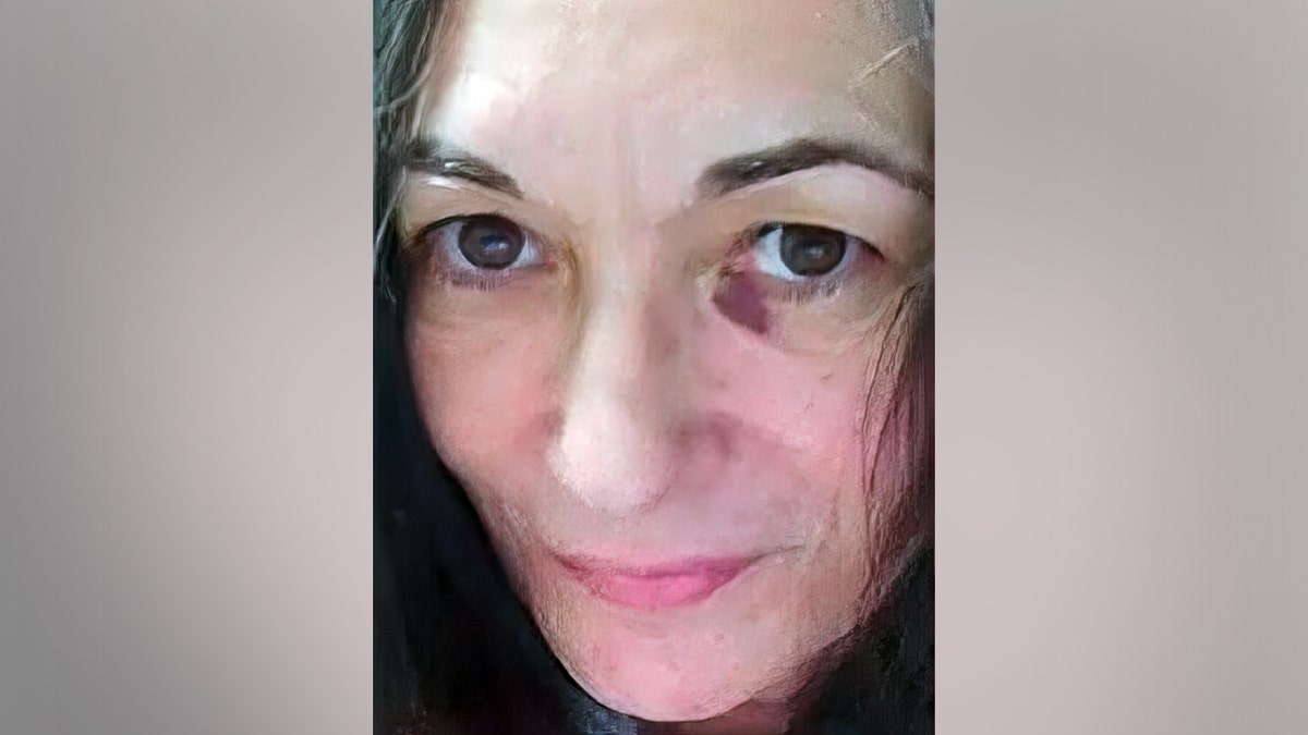 Ghislaine Maxwell, Jeffrey Epstein pal, sports black eye in photo showing poor jail conditions