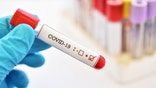 Blood sample tube positive with COVID-19 or novel coronavirus 2019 found in Wuhan, China