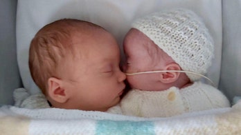 Woman gives birth to twins conceived 3 weeks apart