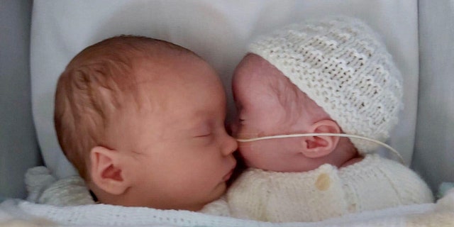 'Superfetation'- twins conceived 3 weeks apart, follow News Without Politics, NWP, conception, birth, pregnancy ,top health and wellness non political news stories