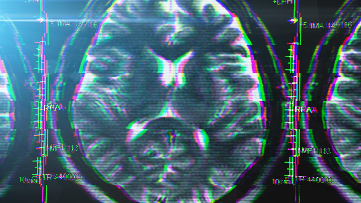 Brain scan picture