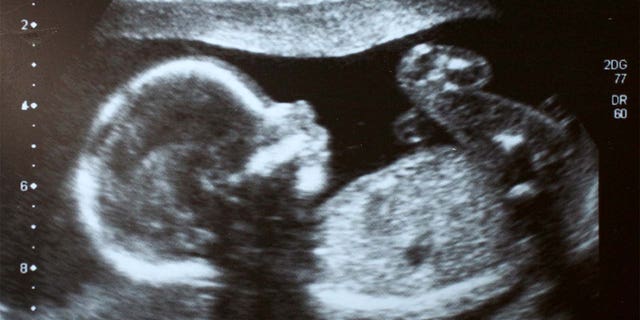 Fetus ultrasound