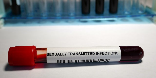 Data showed about a 60% decrease in STI testing in early April, but an increasing positivity rate for both chlamydia and gonorrhea.