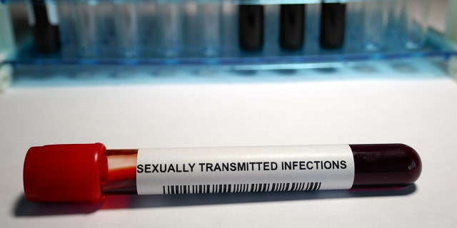 Data showed about a 60% decrease in STI testing in early April, but an increasing positivity rate for both chlamydia and gonorrhea.