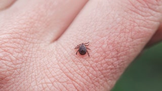 Maine confirms tick-borne Powassan virus case: symptoms to watch for