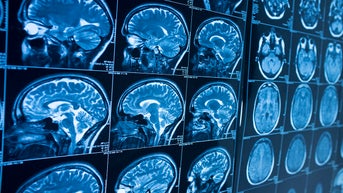 The brain may undergo a major transformation around age 50, new study finds - Fox News