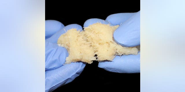 FiberCel Fiber Viable Bone Matrix (Photo courtesy of Aziyo Biologics)