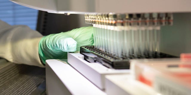 In this 2019 photo provided by Biogen, a researcher works on the development of the medication aducanumab in Cambridge, Mass. 