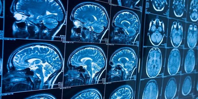 A screen shows multiple MRI brain scans.