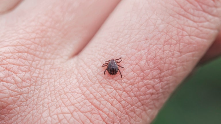Maine confirms tick-borne Powassan virus case: Symptoms to watch for