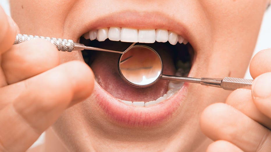 Ask a doc: ‘Why do my gums bleed after I brush my teeth, and what should I do about it?’