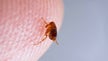 Colorado reports plague-infected fleas and animals, blames disease for 10-year-old's death
